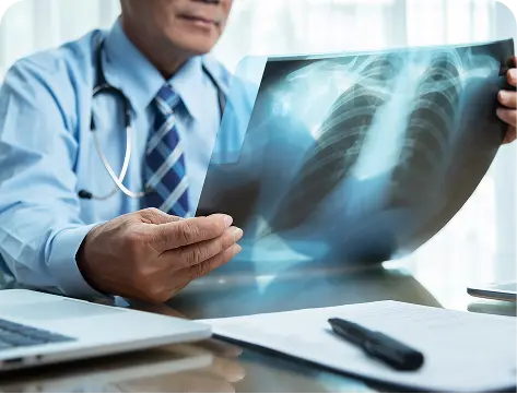 A doctor analyzing a chest x-ray for an asthma patient